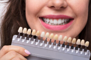 caring for your veneers castle hill