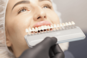 how to care for your veneers castle hill