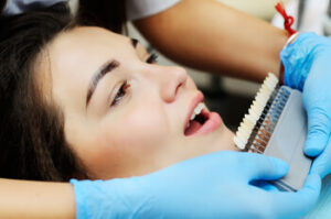 required dental shave veneers castle hill