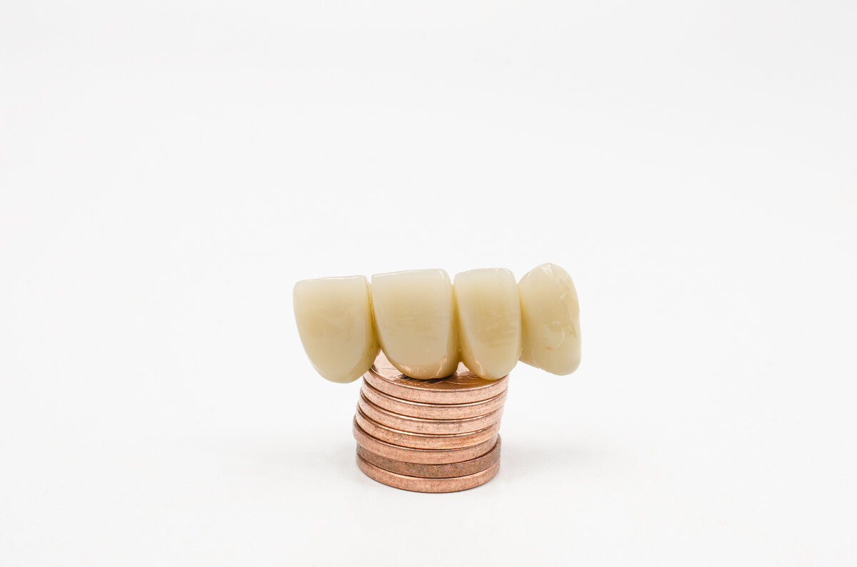 teeth veneers price castle hill