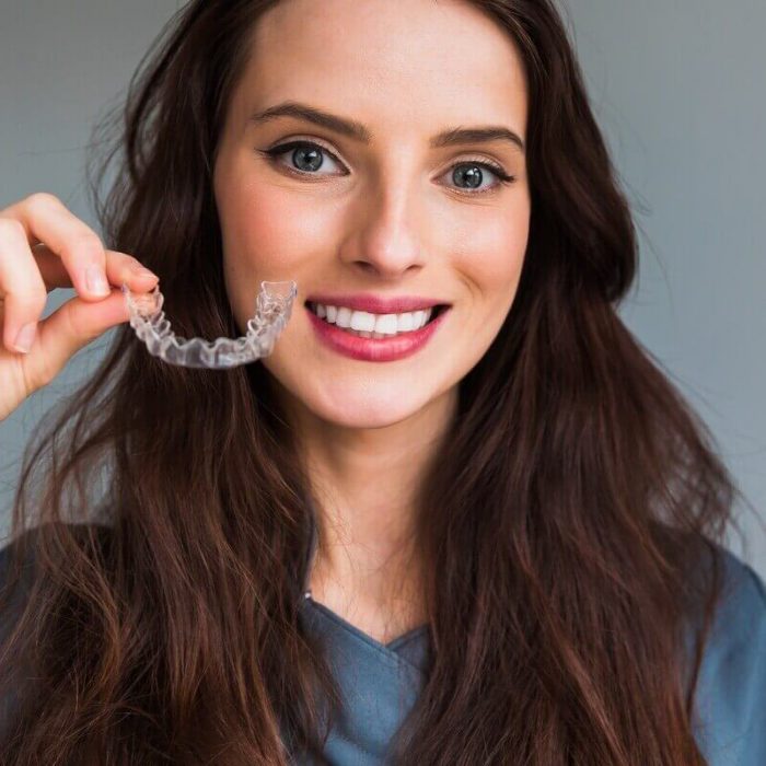 what is invisalign castle hill
