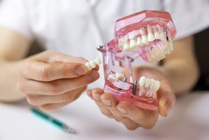 dental implant cost thailand planning