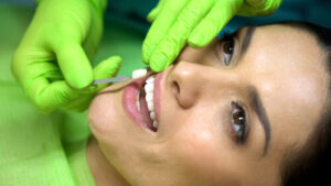 how much do veneers cost in bali check