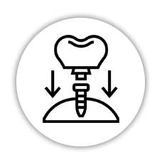 Single Implant icon