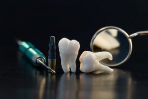 cheapest tooth implants castle hill