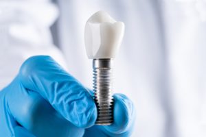 out of the country dental implants charges castle h