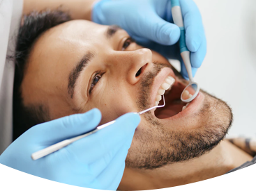 Teeth Whitening dural