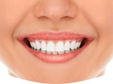 dental implants dundas valley