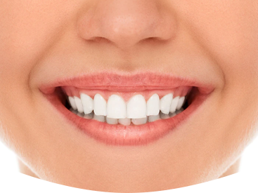 dental implants normanhurst
