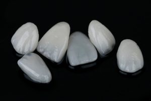 dentist for veneers shells