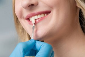 Do Veneers Help with Sensitive Teeth application