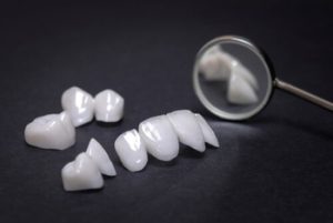 How Are Veneers Fitted shells