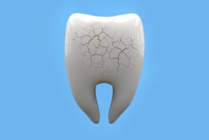 How to Stop Teeth Grinding crack