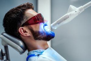 professional teeth whitening procedure