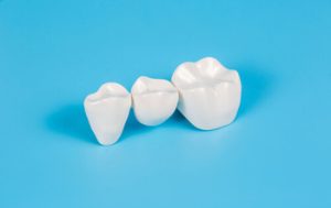 Types of Dental Crowns and Cost porcelain