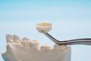 Types of Dental Crowns and Cost shell