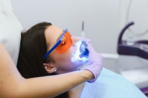 White Calcium Spots on Teeth whitening