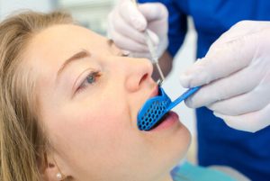 How to Whiten Teeth with Braces impression