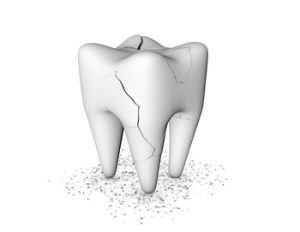 Toothache,,Dental,Care,Concept.,Unhealthy,,Cracked,And,Broken,Teeth,On