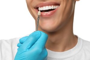 Porcelain Veneers Procedure use