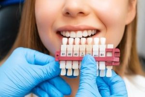 Teeth Whitening Aftercare check