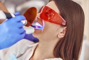 Teeth Whitening Aftercare professional