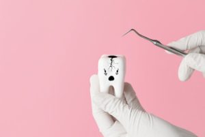 Tooth Decay in Children problem