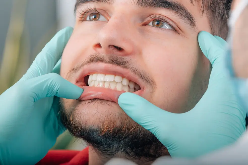 Gum Disease