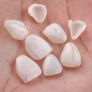 Are Porcelain Veneers Worth It shells