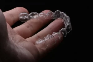 How Long Do Aligners Take to Work invisalign