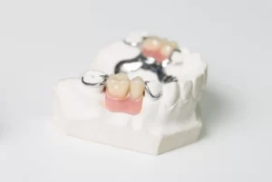 How Long Do Dentures Take to Make partial