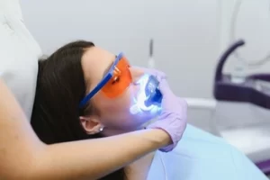Unbearable Pain After Teeth Whitening check
