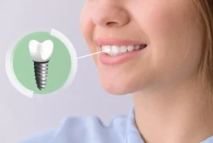 are dental implants safe results