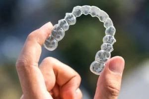 How Do Clear Aligners Work tray