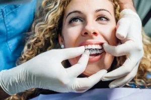 How Does Orthodontic Treatment Work aligners
