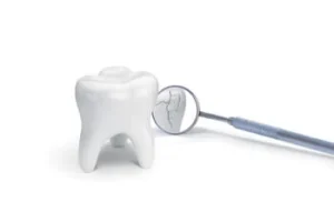 Tooth Sensitivity After a Filling crack