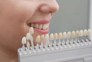 what are porcelain veneers teeth colour